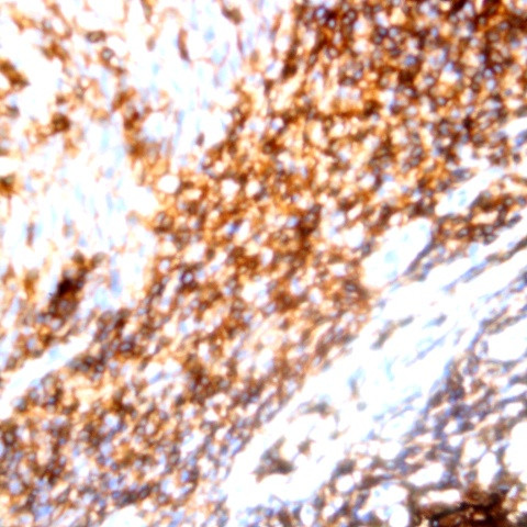 CD79a Antibody in Immunohistochemistry (Paraffin) (IHC (P))