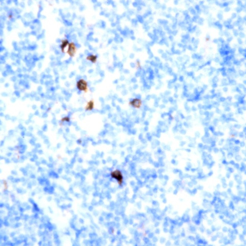 CD29 Antibody in Immunohistochemistry (Paraffin) (IHC (P))
