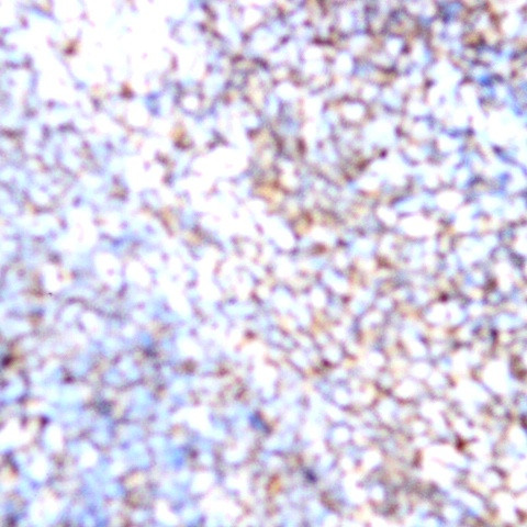 CD184 (CXCR4) Antibody in Immunohistochemistry (Paraffin) (IHC (P))