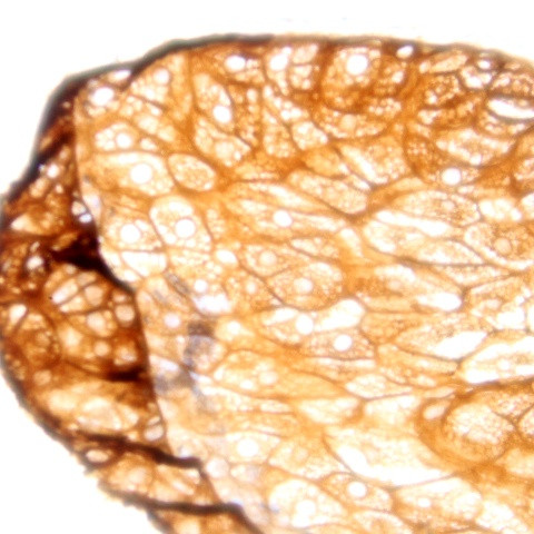 Ganglioside GD2 Antibody in Immunohistochemistry (Paraffin) (IHC (P))