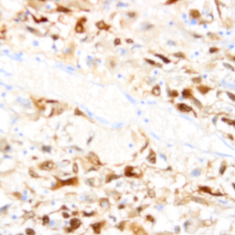 B7H4 (VTCN1) Antibody in Immunohistochemistry (Paraffin) (IHC (P))