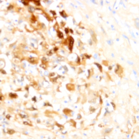 PD-L1 (CD274) Antibody in Immunohistochemistry (Paraffin) (IHC (P))