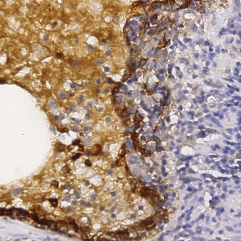 Thyroglobulin Antibody in Immunohistochemistry (Paraffin) (IHC (P))