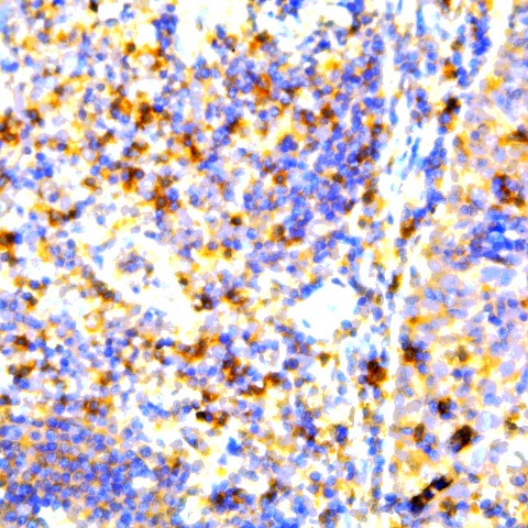 ZAP-70 Antibody in Immunohistochemistry (Paraffin) (IHC (P))