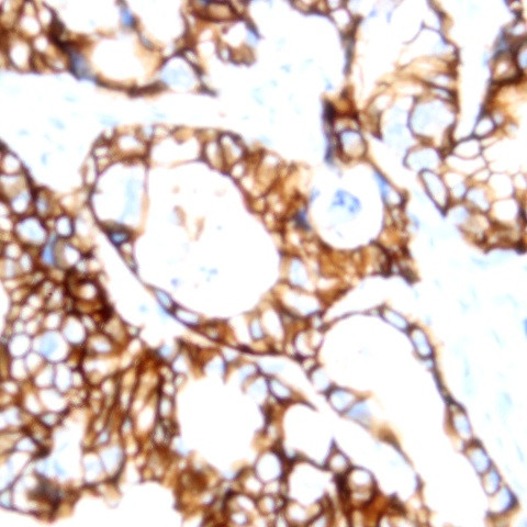 Cadherin-Ksp Antibody in Immunohistochemistry (Paraffin) (IHC (P))