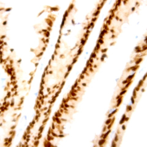 Cyclin D1 Antibody in Immunohistochemistry (Paraffin) (IHC (P))