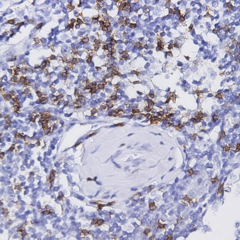 Perforin Antibody in Immunohistochemistry (Paraffin) (IHC (P))