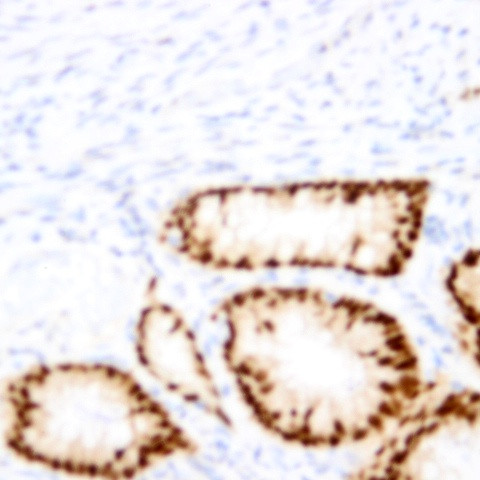 NBD1 Antibody in Immunohistochemistry (Paraffin) (IHC (P))