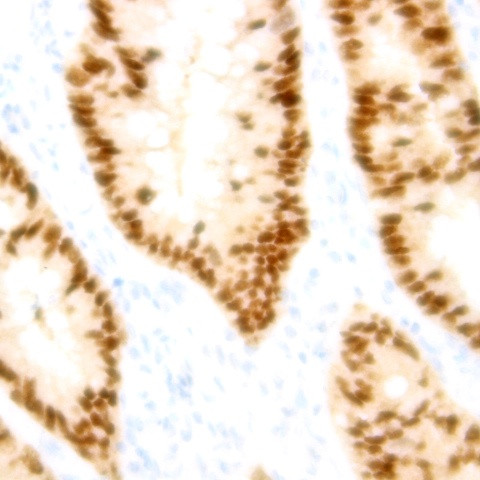 NBD1 Antibody in Immunohistochemistry (Paraffin) (IHC (P))