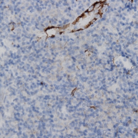 TTF1 (thyroid transcription factor 1) Antibody in Immunohistochemistry (Paraffin) (IHC (P))