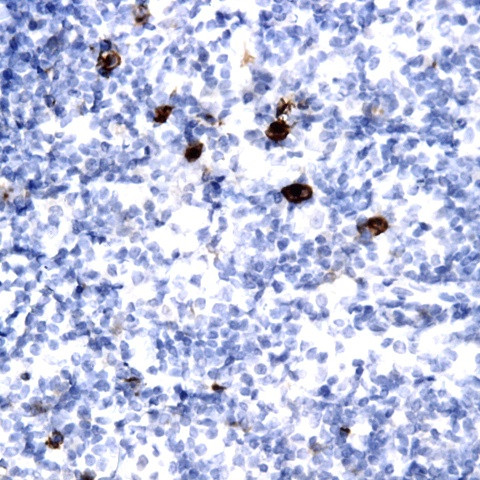 TdT Antibody in Immunohistochemistry (Paraffin) (IHC (P))