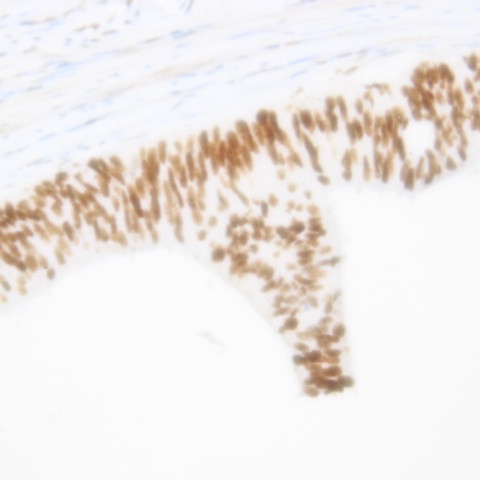 MDM2 Antibody in Immunohistochemistry (Paraffin) (IHC (P))