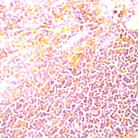 IL-2 Antibody in Immunohistochemistry (Paraffin) (IHC (P))