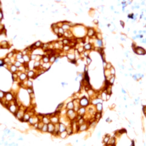 TNF-a Antibody in Immunohistochemistry (Paraffin) (IHC (P))