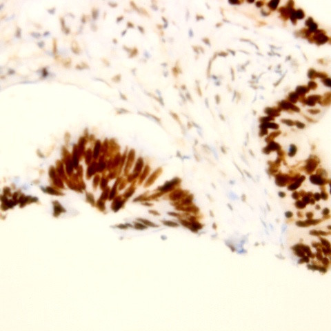 Progesterone Receptor (PR) Antibody in Immunohistochemistry (Paraffin) (IHC (P))