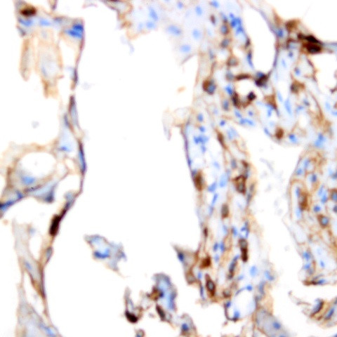 GUCY1B3 (GCS-b-1) Antibody in Immunohistochemistry (Paraffin) (IHC (P))