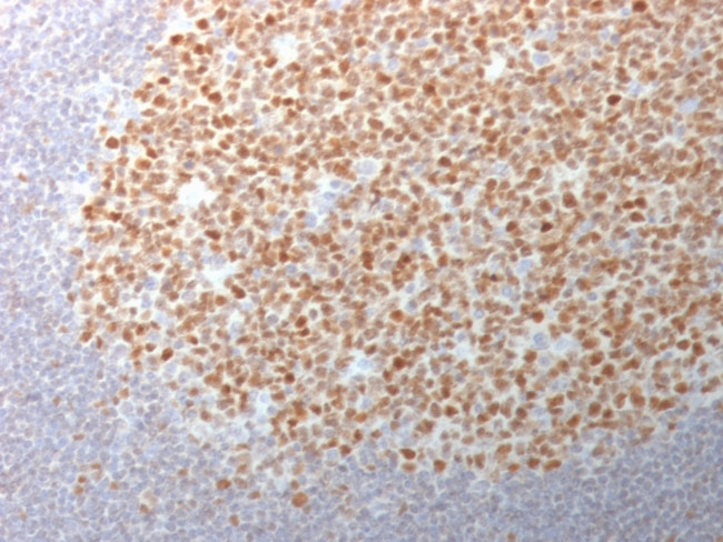 Bcl-6 Antibody in Immunohistochemistry (Paraffin) (IHC (P))