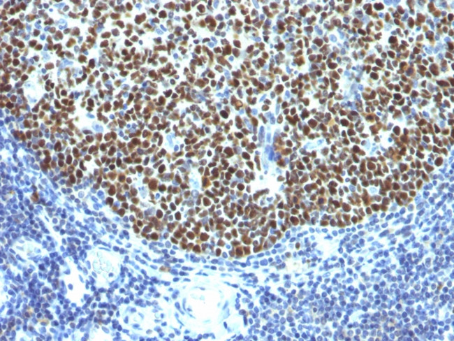 Bcl-6 (Follicular Lymphoma Marker) Antibody in Immunohistochemistry (Paraffin) (IHC (P))