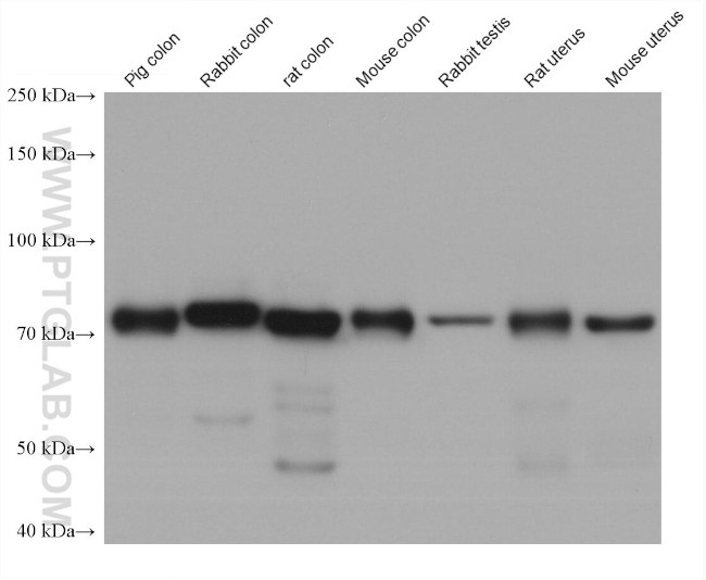 EVI1 Antibody in Western Blot (WB)