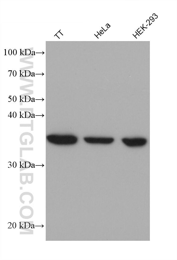 BUB1B Antibody in Western Blot (WB)