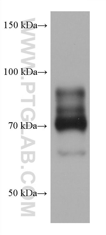 PIAS1 Antibody in Western Blot (WB)