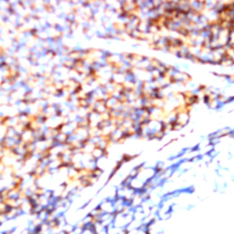 CD158b Antibody in Immunohistochemistry (Paraffin) (IHC (P))