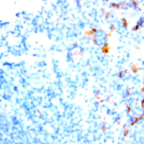 CD26 Antibody in Immunohistochemistry (Paraffin) (IHC (P))