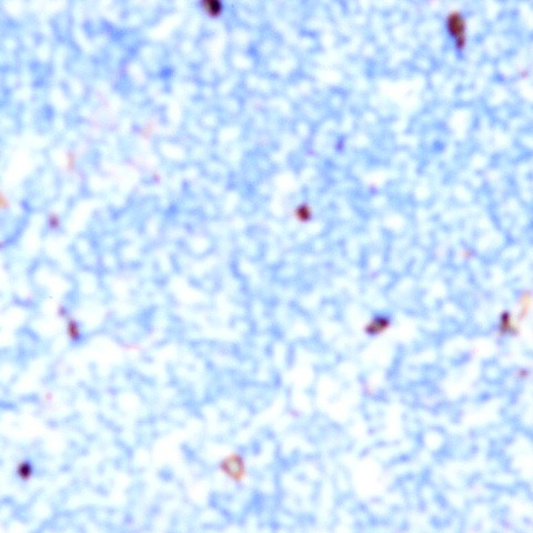 CD80 Antibody in Immunohistochemistry (Paraffin) (IHC (P))