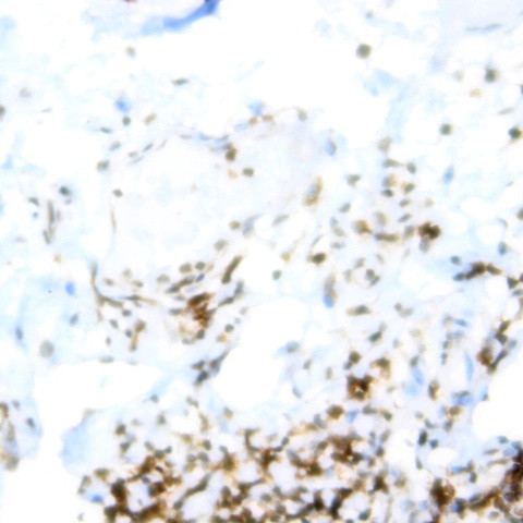 CD81 (TAPA-1) Antibody in Immunohistochemistry (Paraffin) (IHC (P))