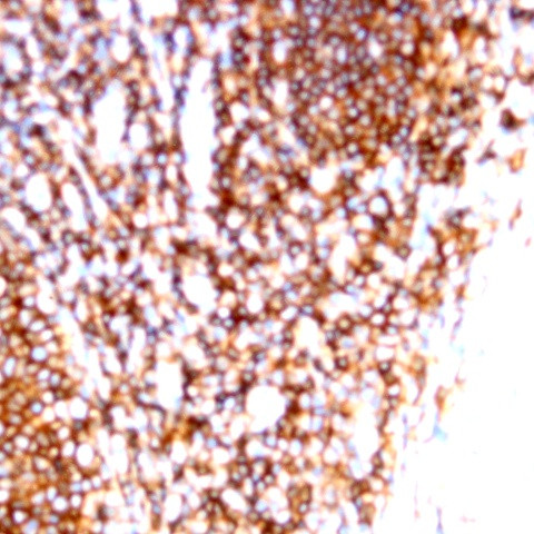 CD99 Antibody in Immunohistochemistry (Paraffin) (IHC (P))