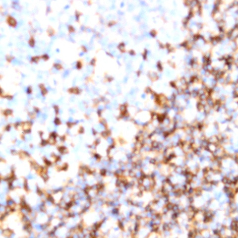 TCRr/d Antibody in Immunohistochemistry (Paraffin) (IHC (P))