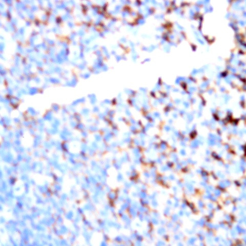 CD11a Antibody in Immunohistochemistry (Paraffin) (IHC (P))