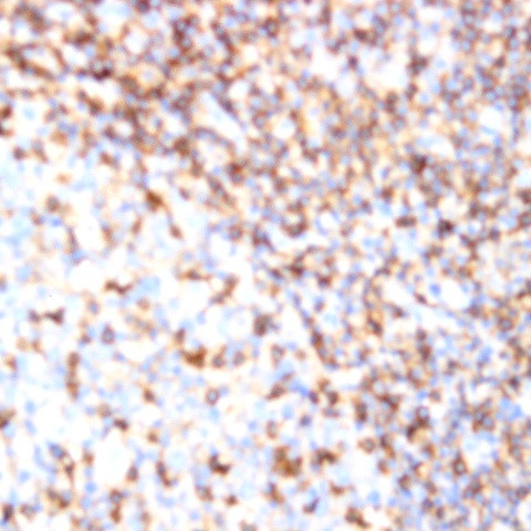 CD11b Antibody in Immunohistochemistry (Paraffin) (IHC (P))
