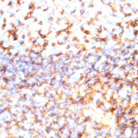 CD11b Antibody in Immunohistochemistry (Paraffin) (IHC (P))