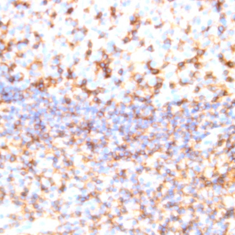 CD11c Antibody in Immunohistochemistry (Paraffin) (IHC (P))