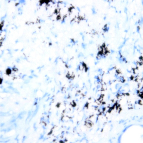 CD123 Antibody in Immunohistochemistry (Paraffin) (IHC (P))
