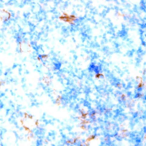 CD13 Antibody in Immunohistochemistry (Paraffin) (IHC (P))