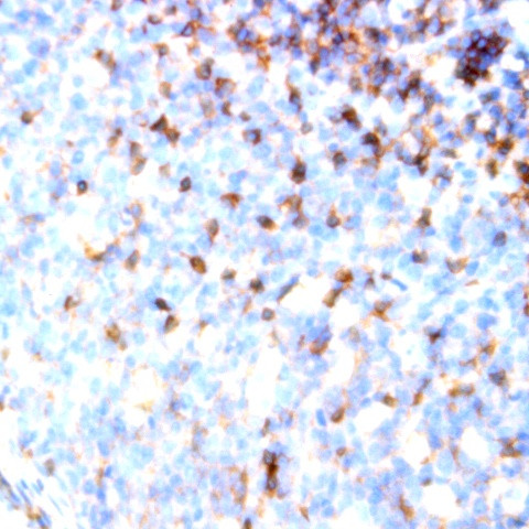 CD161 Antibody in Immunohistochemistry (Paraffin) (IHC (P))