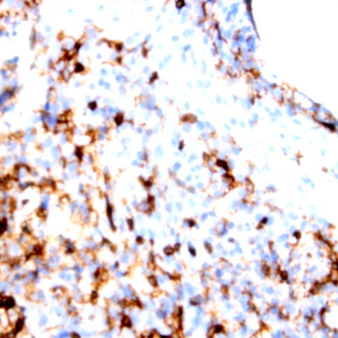 CD1a Antibody in Immunohistochemistry (Paraffin) (IHC (P))