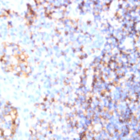 CD200 Antibody in Immunohistochemistry (Paraffin) (IHC (P))