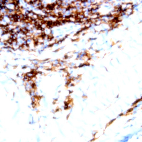CD23 Antibody in Immunohistochemistry (Paraffin) (IHC (P))