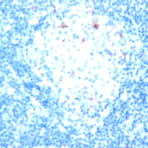 CD52 Antibody in Immunohistochemistry (Paraffin) (IHC (P))