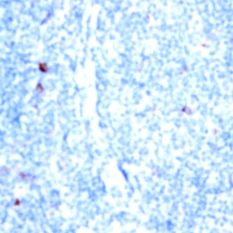 CD52 Antibody in Immunohistochemistry (Paraffin) (IHC (P))