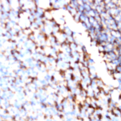 CD56 Antibody in Immunohistochemistry (Paraffin) (IHC (P))