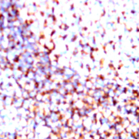 CD21 Antibody in Immunohistochemistry (Paraffin) (IHC (P))