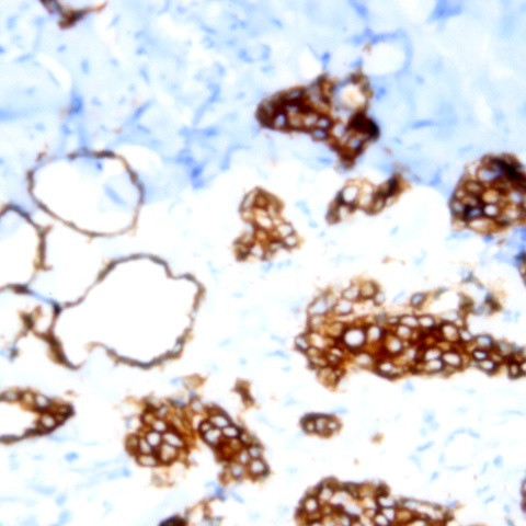 Cytokeratin (Pan) Antibody in Immunohistochemistry (Paraffin) (IHC (P))