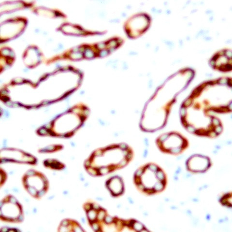 Cytokeratin (HMW) Antibody in Immunohistochemistry (Paraffin) (IHC (P))