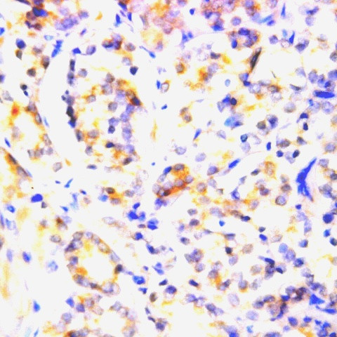 BCL-2 Antibody in Immunohistochemistry (Paraffin) (IHC (P))