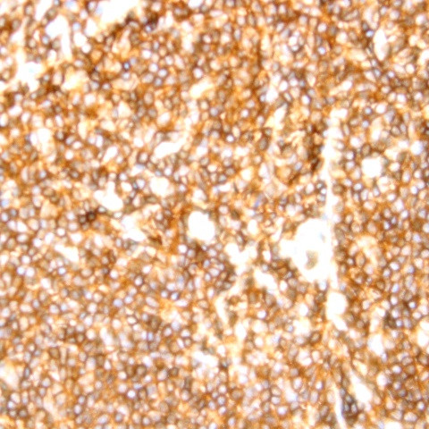 CD20 Antibody in Immunohistochemistry (Paraffin) (IHC (P))