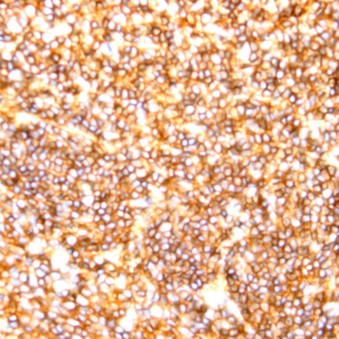 CD20 Antibody in Immunohistochemistry (Paraffin) (IHC (P))